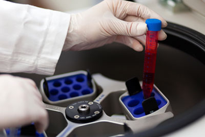 Blood Chemistry